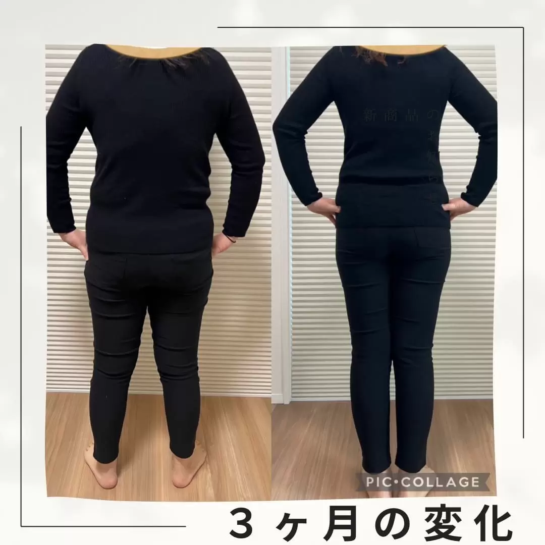 Before / After 04