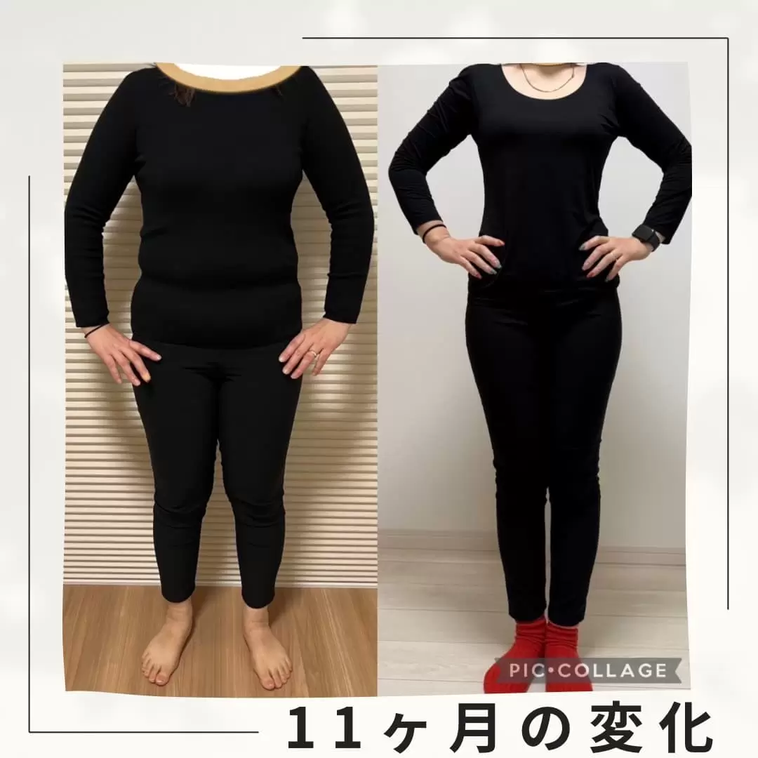 Before / After 07